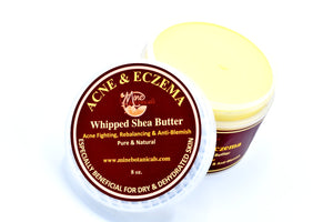 Organic Acne & Eczema Whipped Butter ( 8 Oz ) - Kulcha Kernel
